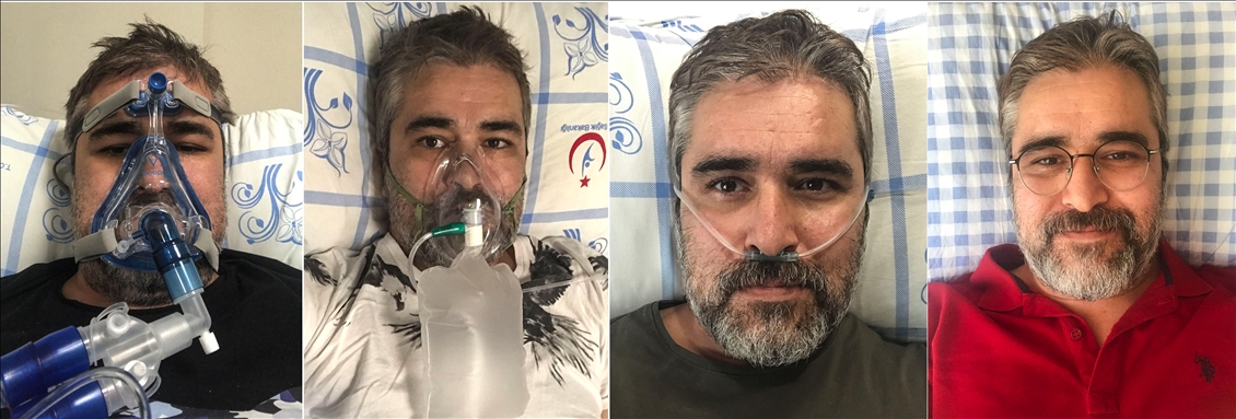 AA photojournalist Aydogan, who beated Covid-19, photograph his treatment process