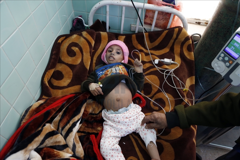 Yemen'deki insani kriz