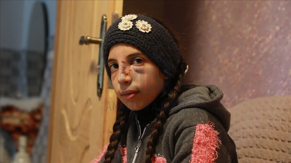 Hala, une fillette palestinienne survit à une attaque des colons
