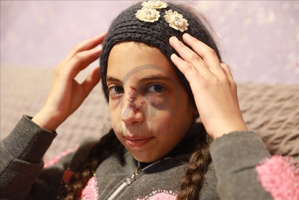 "حلا" طفلة فلسطينية تنجو من اعتداء المستوطنين