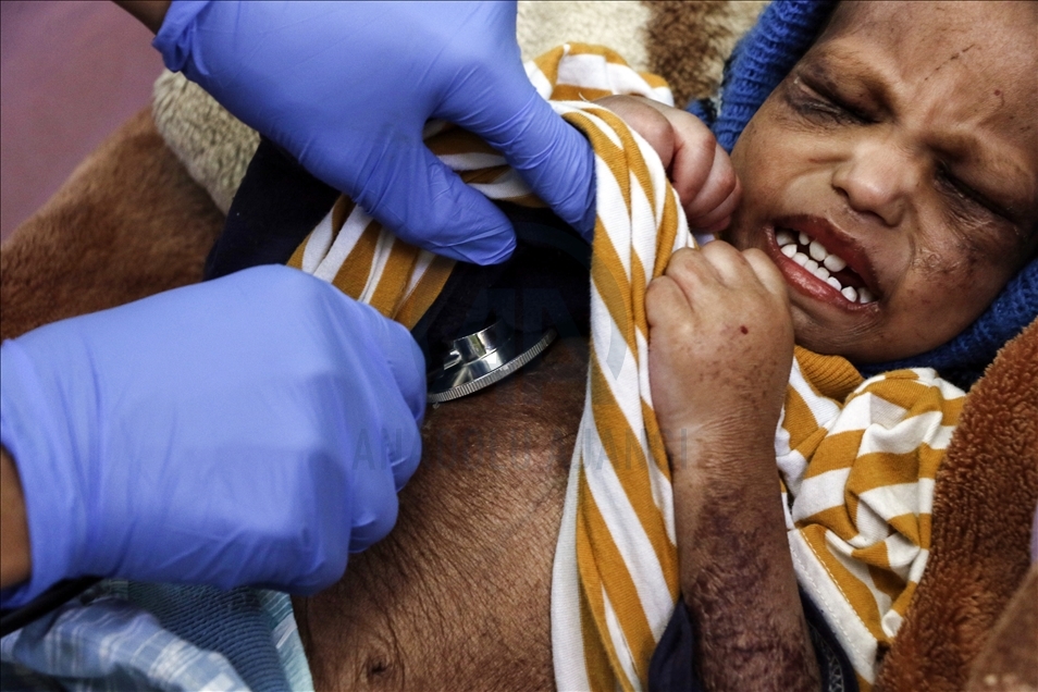 Millions of children confront threat of starvation in Yemen