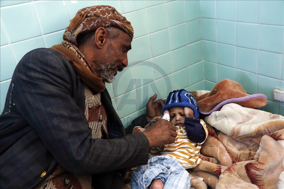 Millions of children confront threat of starvation in Yemen