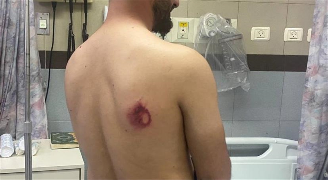 Anadolu Agency's photojournalist and cameraman injured during the intervention of Israeli police in Al-Aqsa Mosque