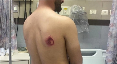 Anadolu Agency journalists injured in Al-Aqsa raid by Israeli police