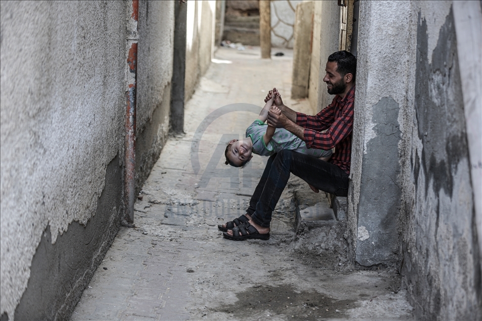 مأساة 3 طفلات في غزة.. مرض نادر يستنزف حياتهن