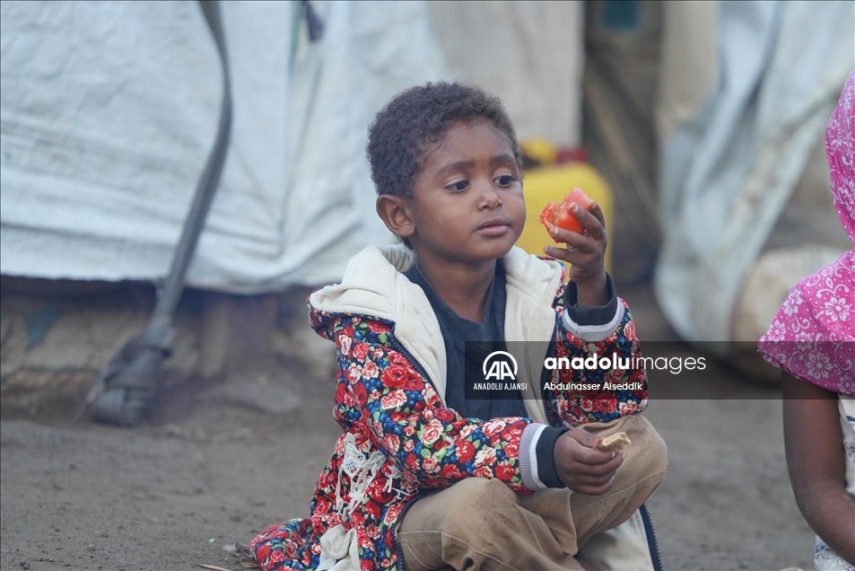 Yemen'de 7 yıldır süren savaşın bedelini mülteci kamplarındaki kadın ve çocuklar ödüyor