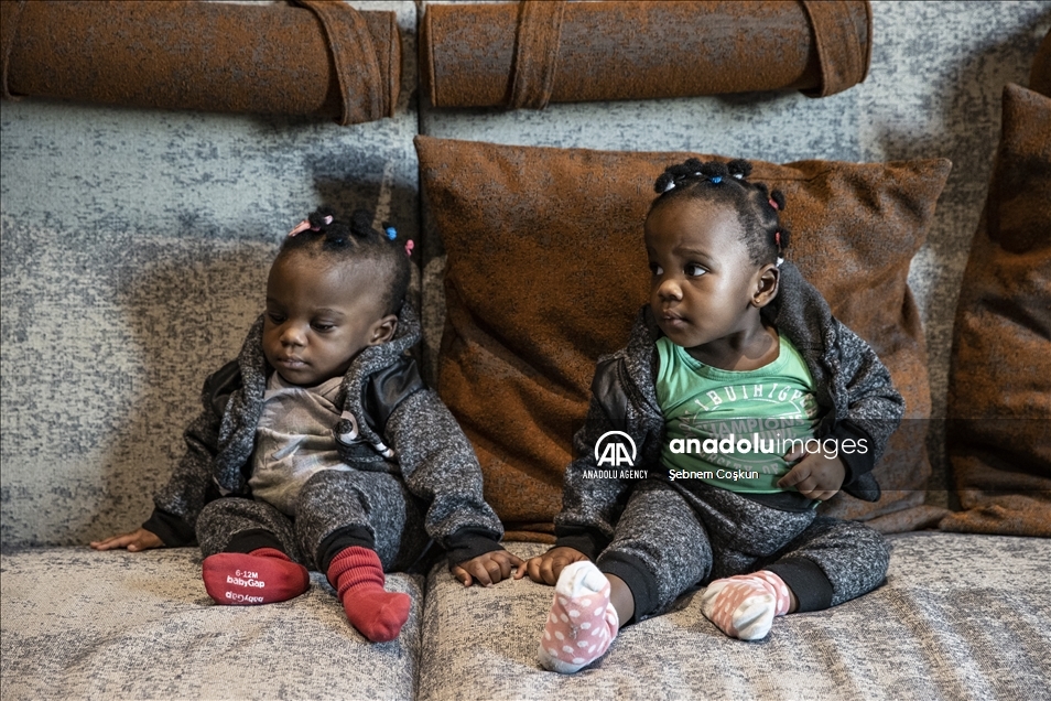 بعد نجاح عملية الفصل.. عائلة التوأم الكاميروني ممتنون لتركيا