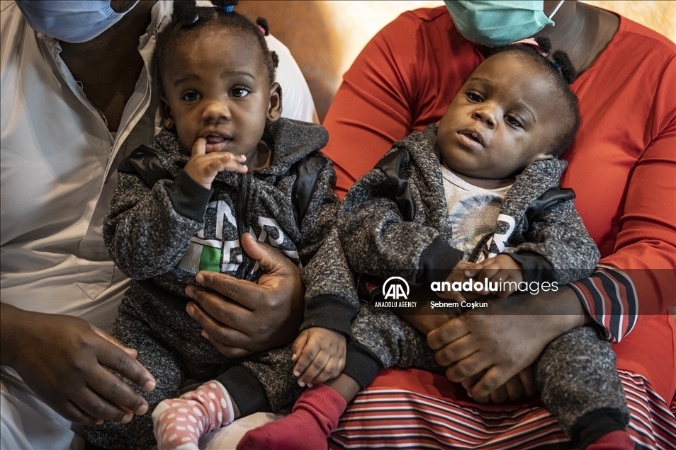 بعد نجاح عملية الفصل.. عائلة التوأم الكاميروني ممتنون لتركيا