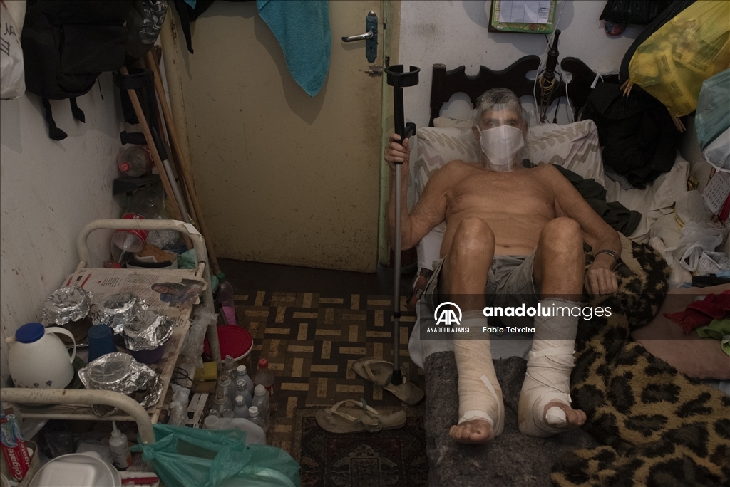 Kovid-19 salgınında Brezilya'da ihmal edilen cüzzam hastaları