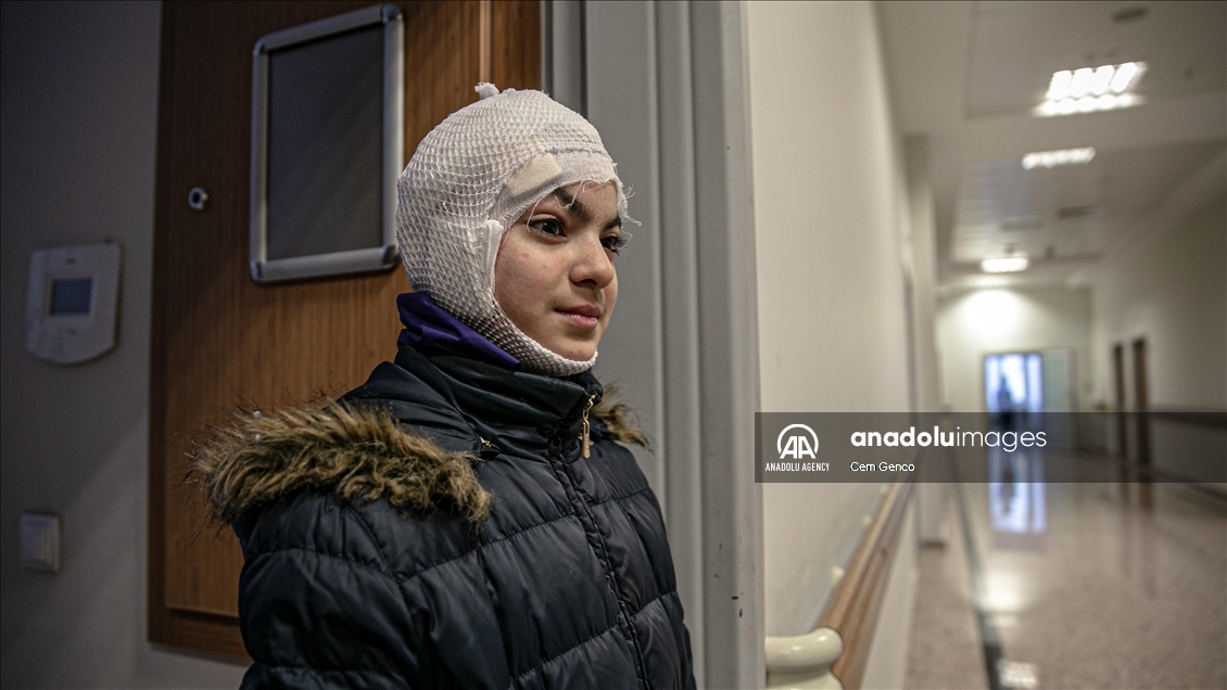 درمان دختر سوری در ترکیه که پوست سرش کنده شده بود