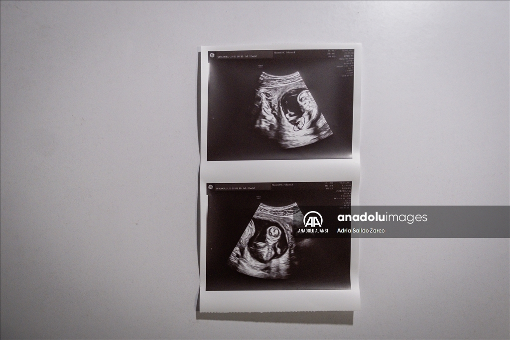 Rusya saldırıları altındaki Ukrayna