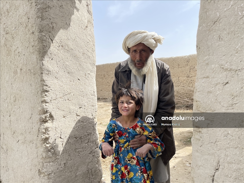 ABD'nin hava saldırısında ailesini kaybeden Afgan kız, yaşadığı travmayı atlatamıyor