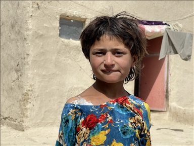 ABD'nin hava saldırısında ailesini kaybeden Afgan kız, yaşadığı travmayı atlatamıyor 