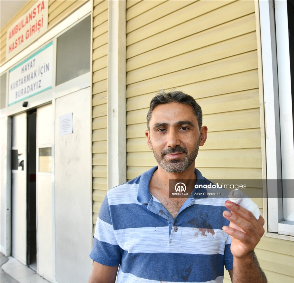 Gaziantep'te "acemi kasaplar" hastanelik oldu