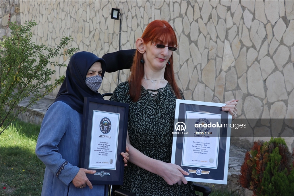 "Dünyanın un uzun boylu kadını" unvanıyla Guinness Rekorlar Kitabı'na giren Rümeysa Gelgi, Karabük'ün Safranbolu ilçesindeki evinin önünde basın açıklaması düzenledi. ( Orhan Kuzu - Anadolu Ajansı )