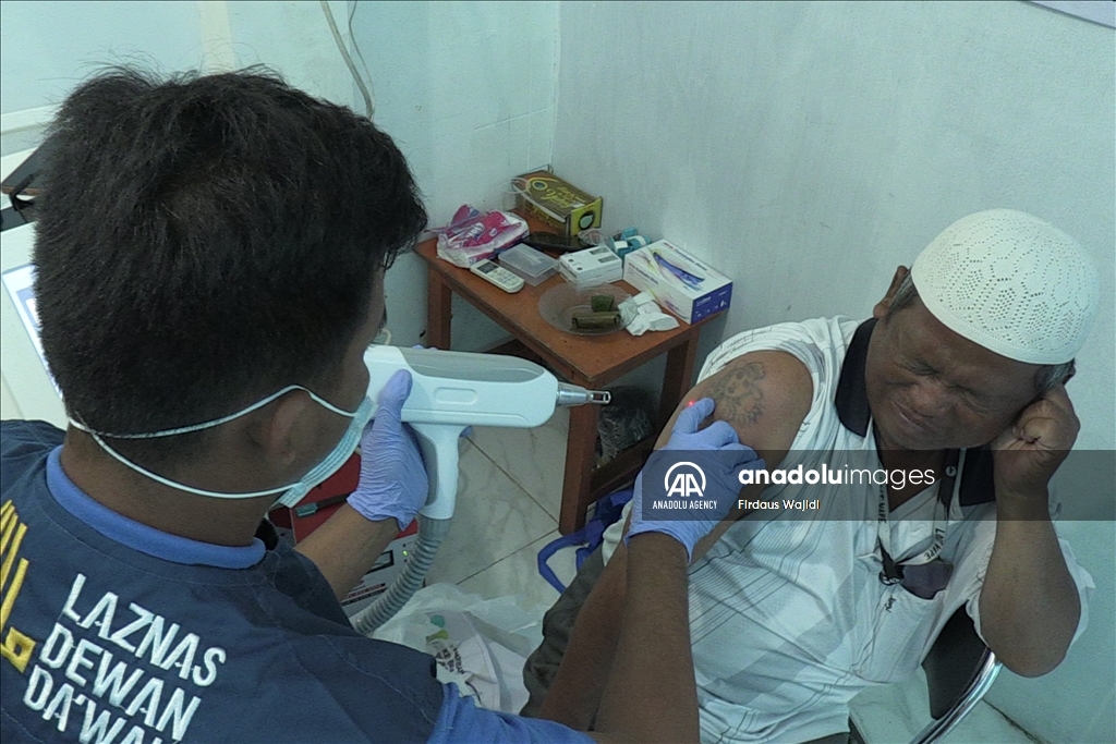 Program hapus tato gratis support Muslim untuk Hijrah