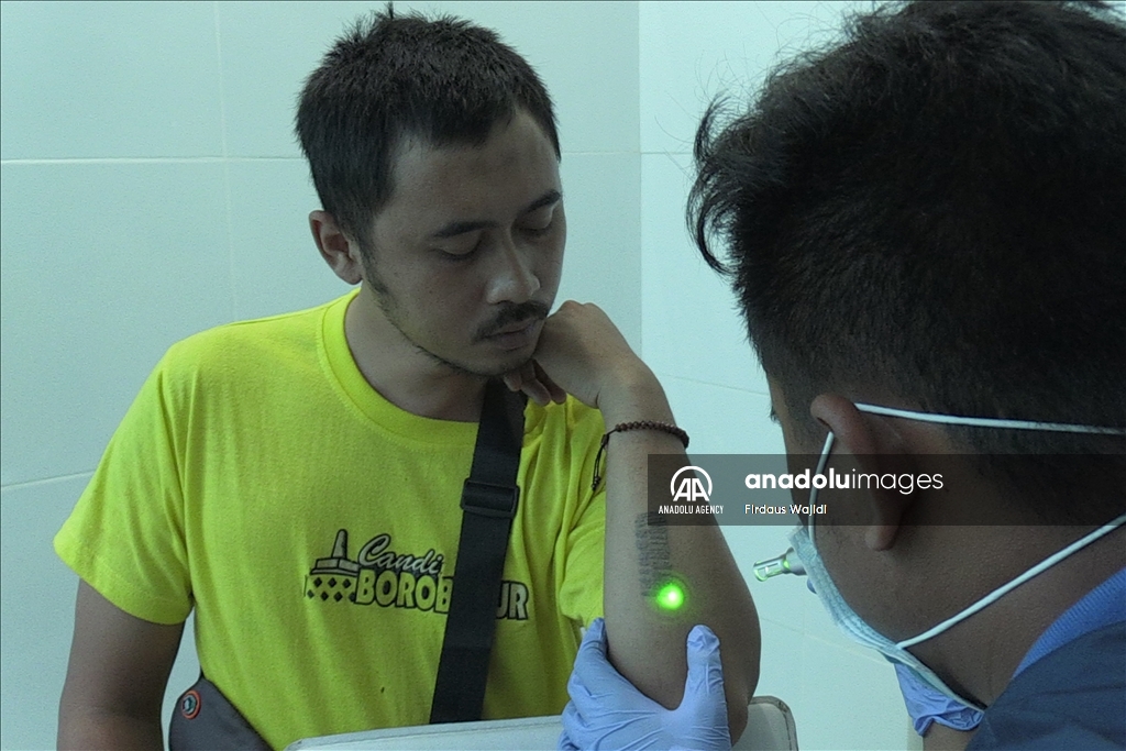 Program hapus tato gratis support Muslim untuk Hijrah
