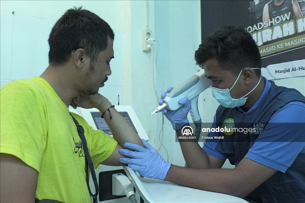 Program hapus tato gratis support Muslim untuk Hijrah