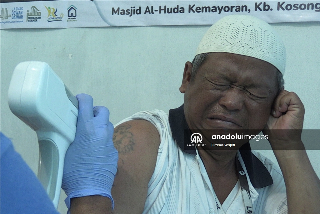 Program hapus tato gratis support Muslim untuk Hijrah