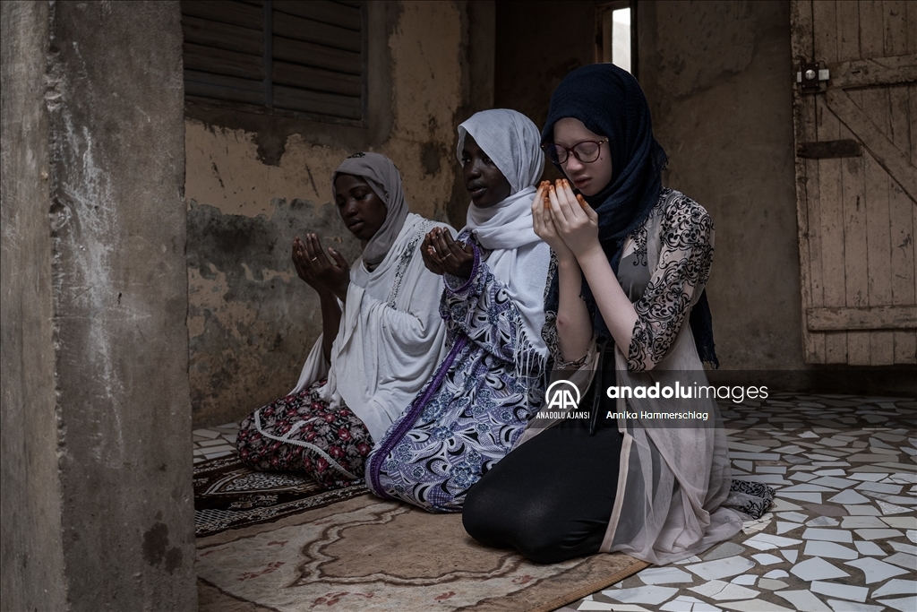 Senegal'da 13 Haziran Dünya Albinizm Farkındalık Günü