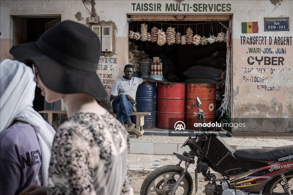 Senegal'da 13 Haziran Dünya Albinizm Farkındalık Günü