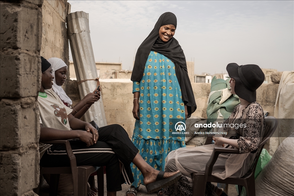 Senegal'da 13 Haziran Dünya Albinizm Farkındalık Günü