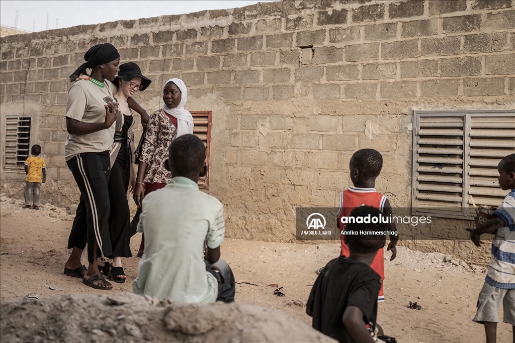 Senegal'da 13 Haziran Dünya Albinizm Farkındalık Günü