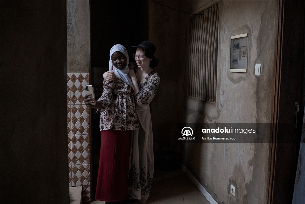 Senegal'da 13 Haziran Dünya Albinizm Farkındalık Günü