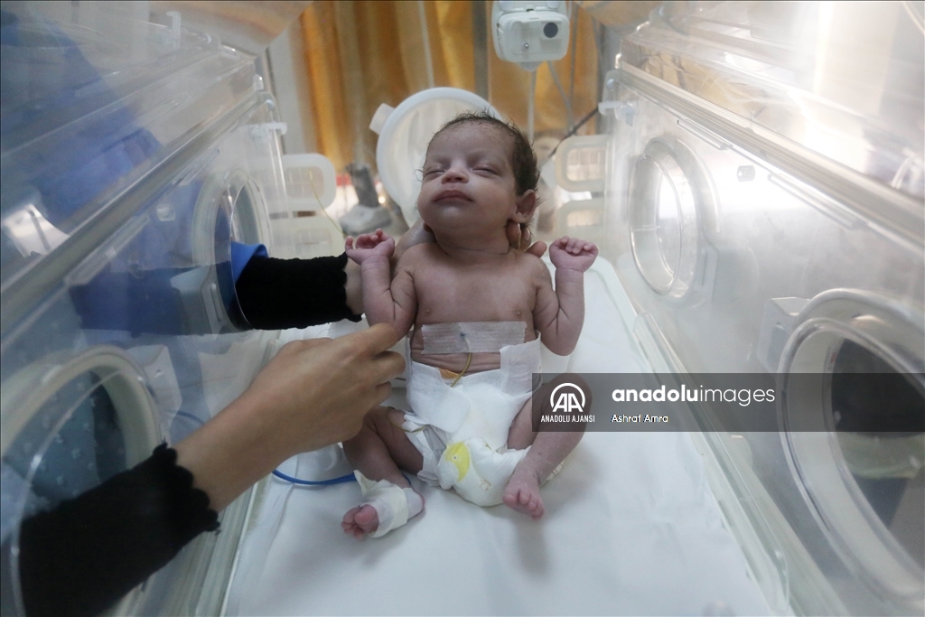 İsrail'in Gazze'ye saldırısında ölen annenin karnındaki bebek kurtarıldı