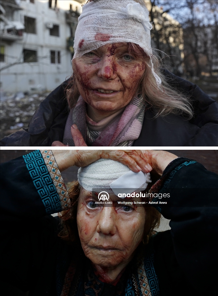 Ukrayna - Gazze: Değişmeyen kareler
