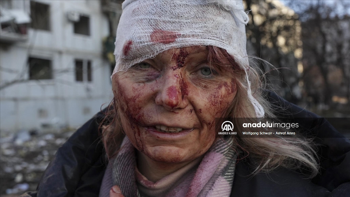 Ukrayna – Gazze: Değişmeyen kareler
