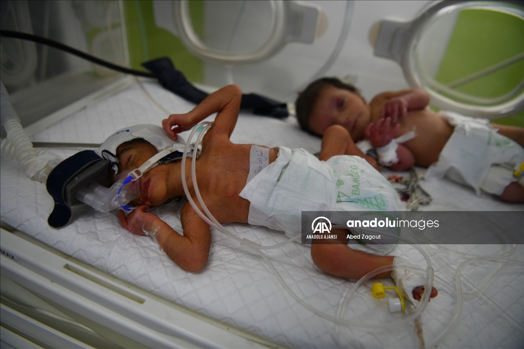 Gazze'deki BAE Hilal Hastanesi'nde bir kuvözü birden fazla prematüre bebek paylaşmak zorunda kalıyor