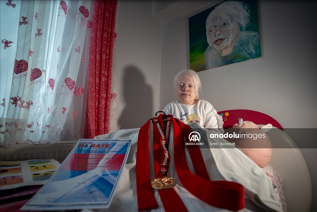 Albinism patient Beyza aspires European championship in karate