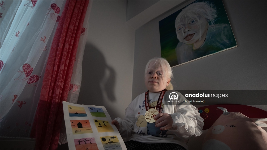 Albinism patient Beyza aspires European championship in karate