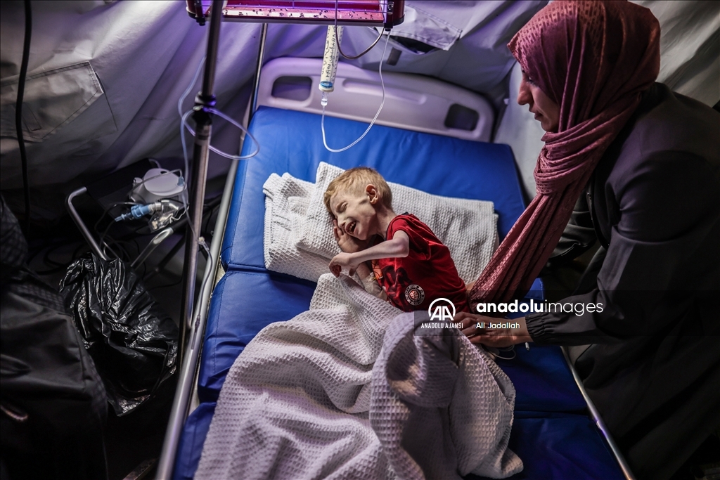 Gazze’nin kuzeyindeki 6 yaşındaki kistik fibrozis hastası ez-Zenat