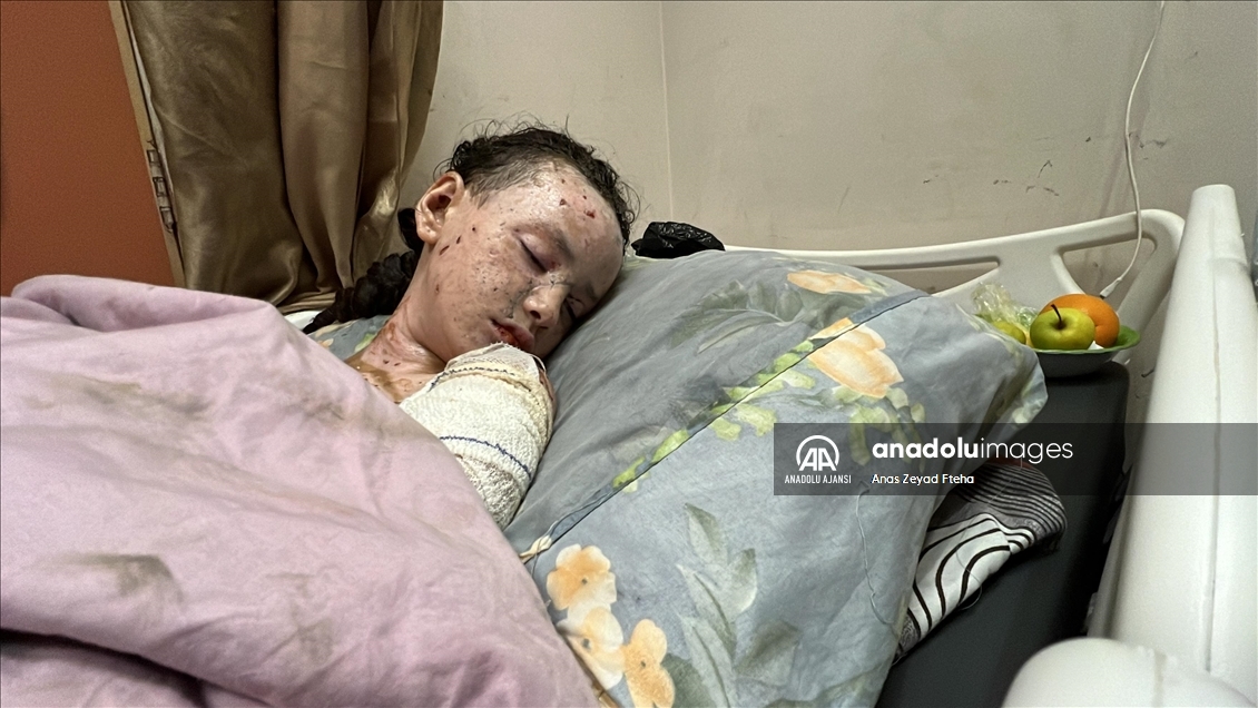 İsrail saldırılarında ağır yaralanan Gazzeli Hanan, yaşam mücadelesi veriyor