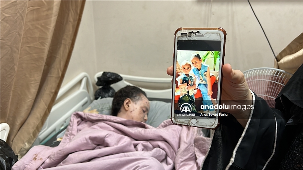 İsrail saldırılarında ağır yaralanan Gazzeli Hanan, yaşam mücadelesi veriyor