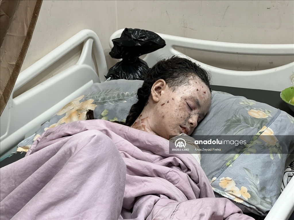 İsrail saldırılarında ağır yaralanan Gazzeli Hanan, yaşam mücadelesi veriyor