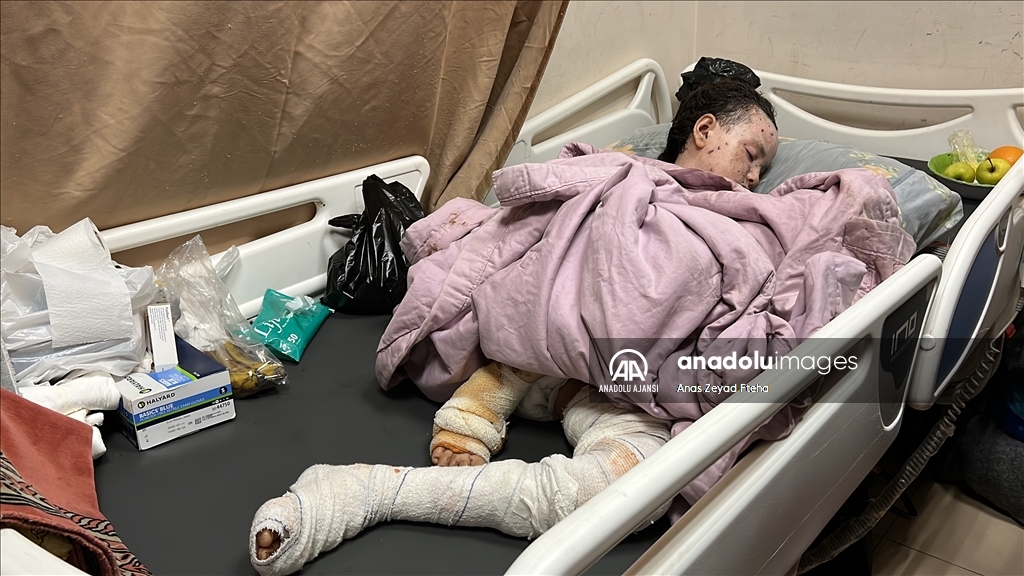 İsrail saldırılarında ağır yaralanan Gazzeli Hanan, yaşam mücadelesi veriyor