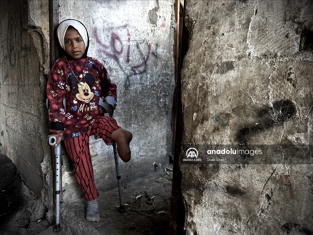 İsrail saldırıları nedeniyle yerinden edilen Ebu Dabbag, engelli çocuklarına bakmak için mücadele veriyor