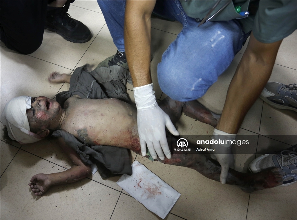 Gazze'de elektrik kesintileri nedeniyle doktorlar yaralı bir çocuğu cep telefonu ışığında tedavi etti ⁣