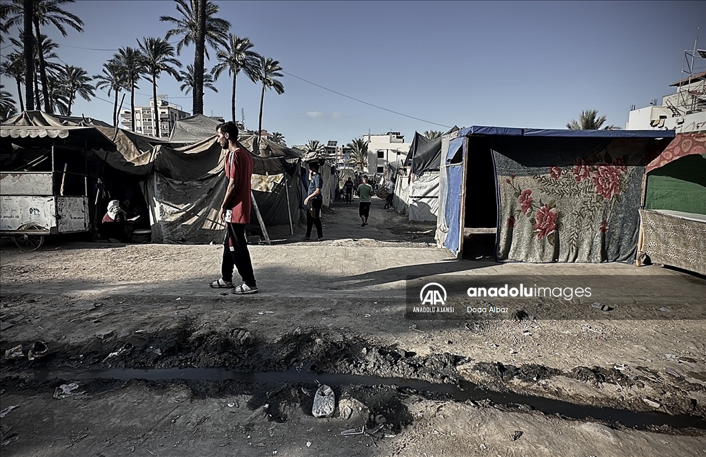 Gazze'de hijyen şartlarının olmadığı çadırlarda kalan çocuklar, çeşitli hastalıklara maruz kalıyor