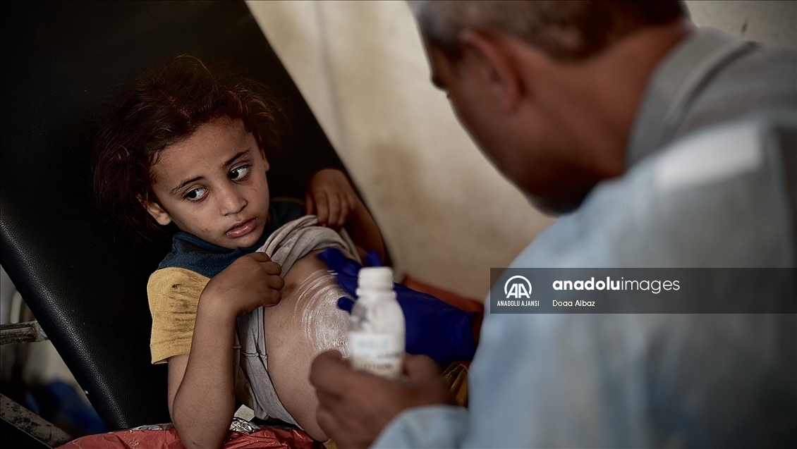 Gazze'de hijyen şartlarının olmadığı çadırlarda kalan çocuklar, çeşitli hastalıklara maruz kalıyor