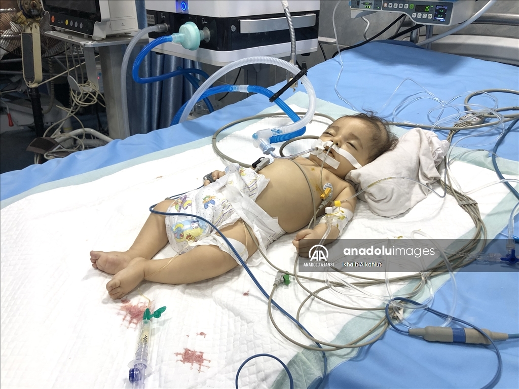 Gazze'deki hastanelerde oksijen yetersizliği hastaların hayatını riske atıyor