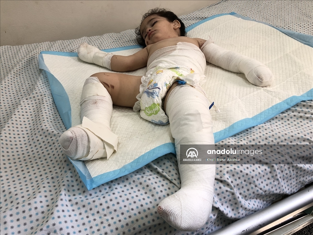 İsrail'in yetim bıraktığı yaralı Filistinli çocuk hastanede yaşam mücadelesi veriyor