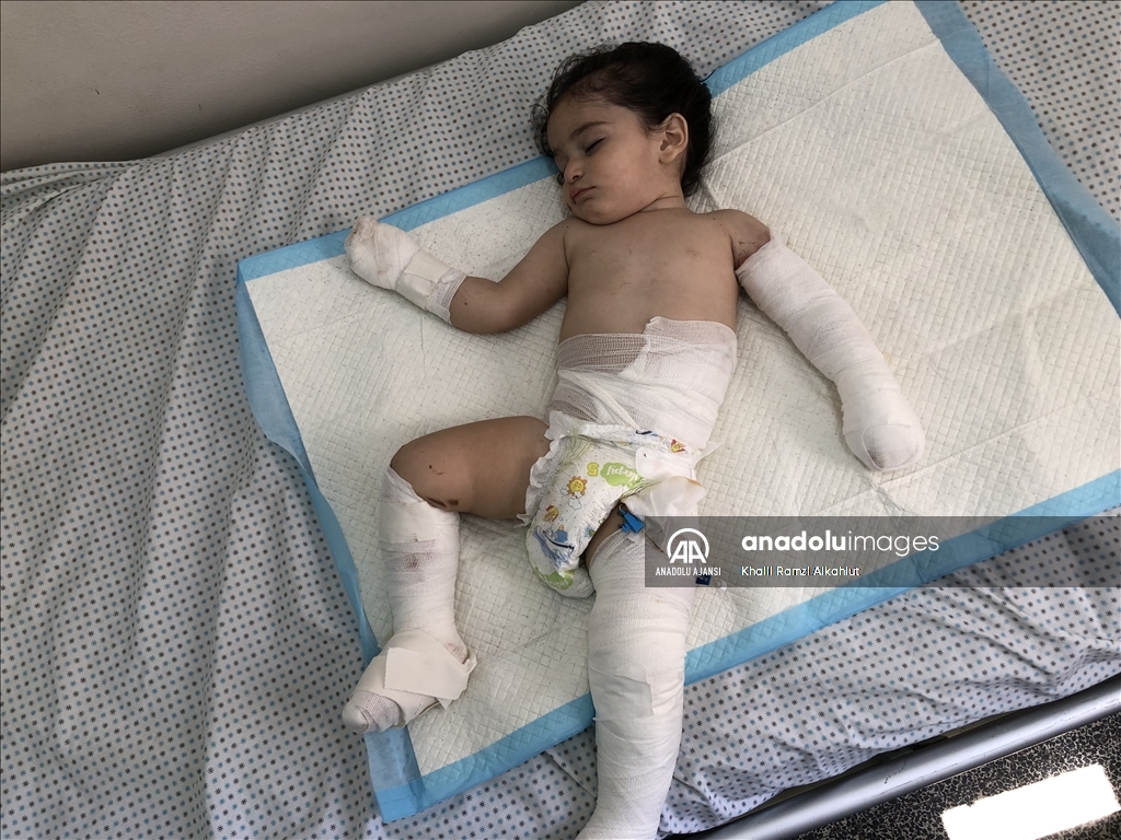 İsrail'in yetim bıraktığı yaralı Filistinli çocuk hastanede yaşam mücadelesi veriyor