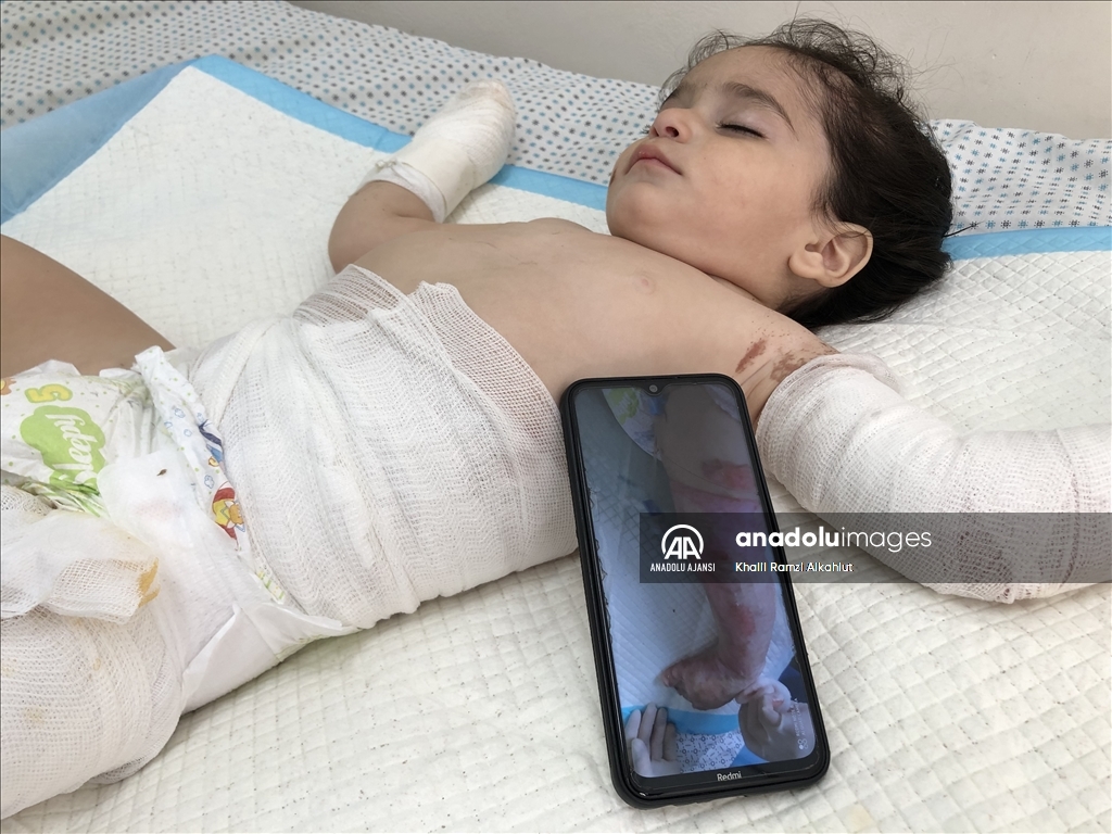 İsrail'in yetim bıraktığı yaralı Filistinli çocuk hastanede yaşam mücadelesi veriyor