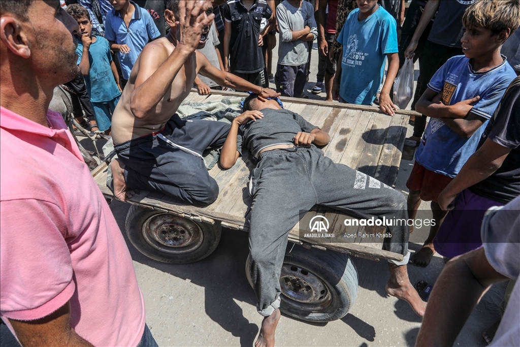 Filistinli bir çocuk, İsrail ordusuna bağlı keskin nişancı tarafından başından vuruldu