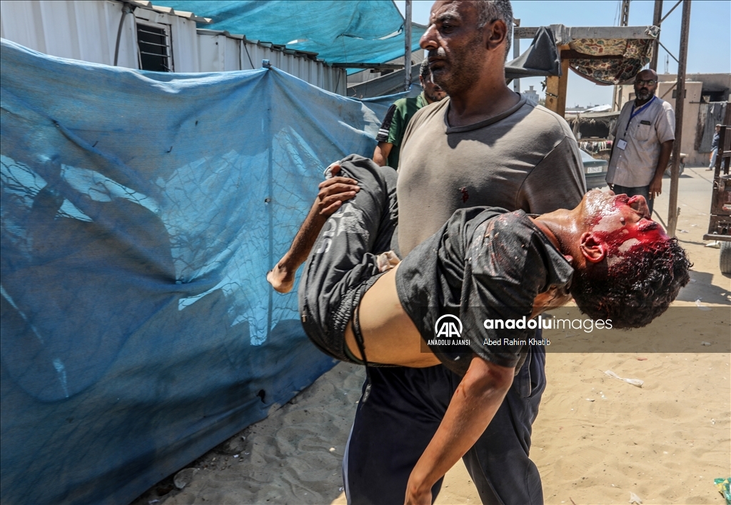 Filistinli bir çocuk, İsrail ordusuna bağlı keskin nişancı tarafından başından vuruldu