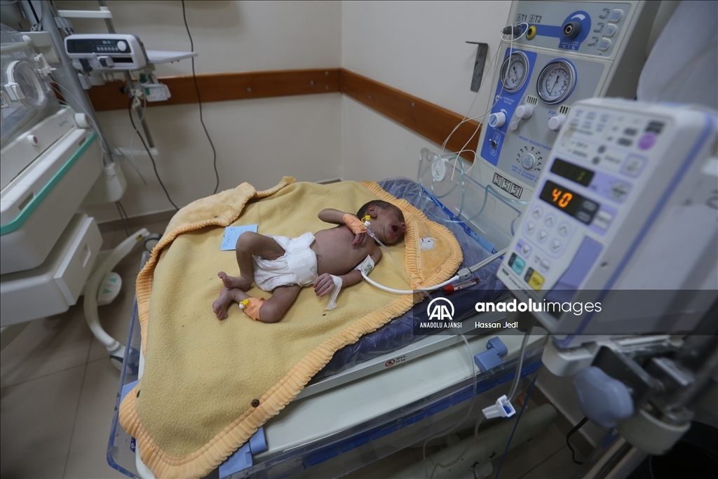 İsrail saldırıları altındaki Gazze'de prematüre bebekler yaşam mücadelesi veriyor